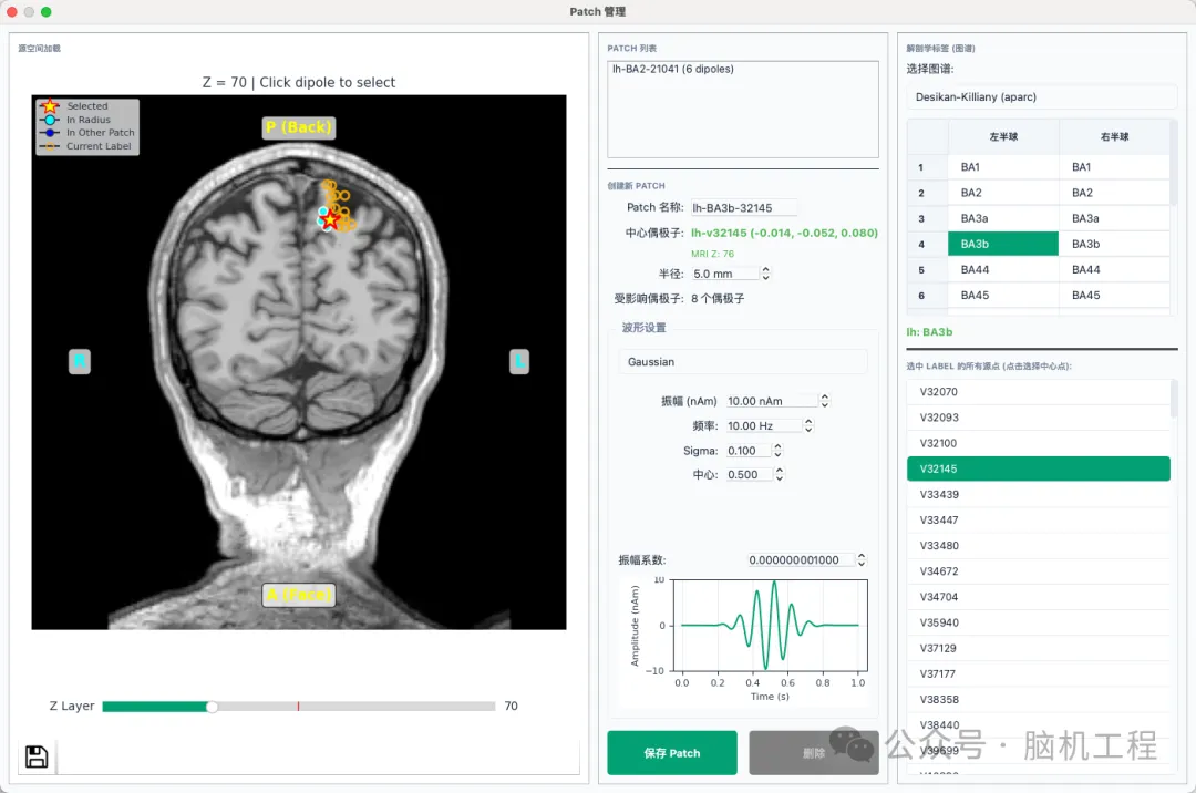 EEG-Simulator